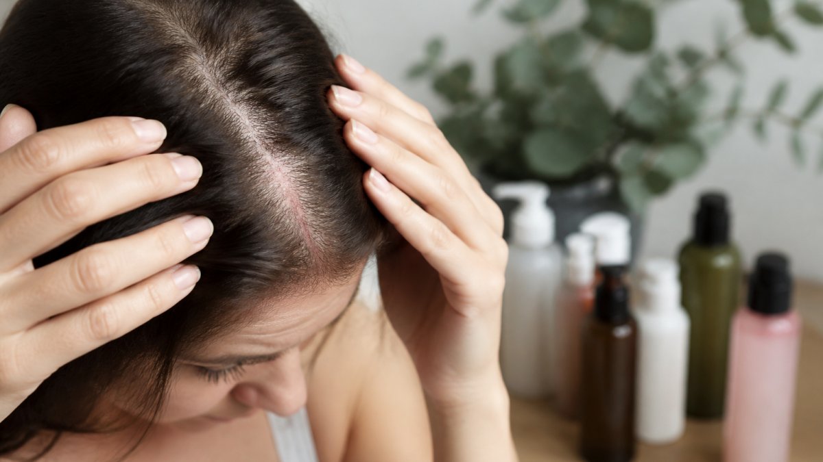 Common Scalp Irritants in Commercial Hair Products